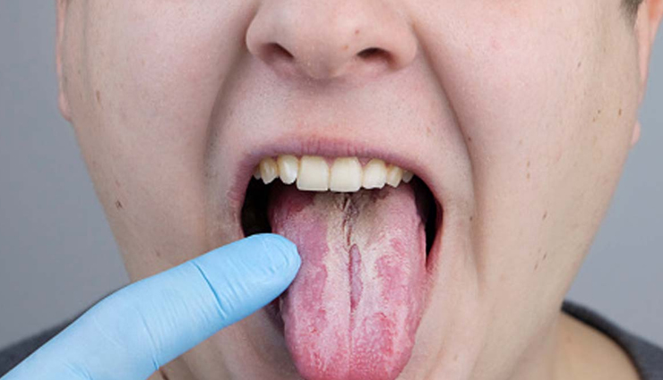 ginger is considered a superfood in ayurveda it cures many health problems,Health,healthy living