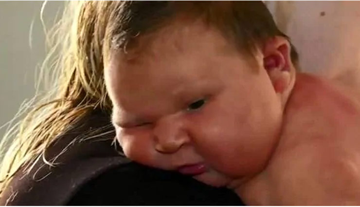 महिला ने दिया 6 किलो वजनी बच्ची को जन्म