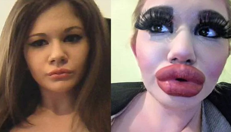 बार्बी डॉल बनना चाहती  है ये महिला, अपने होंठों का आकार किया चार गुना 