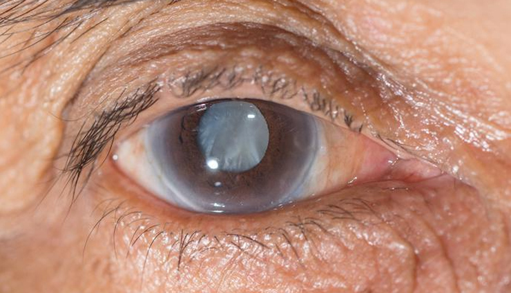 intermittent fasting tips,healthy living,Health tips