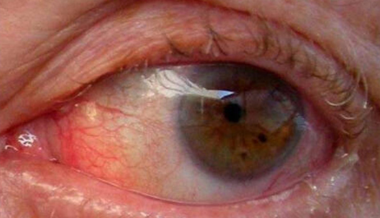 international coffee day,positive and negative effects of coffee,negative effects of coffee on the brain,international coffee day india,side effects of coffee