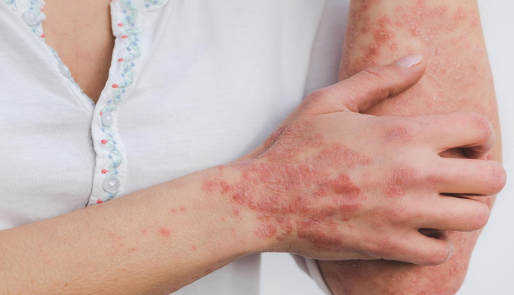 glycerin,beauty benefits of glycerin,glycerin for skin,skin care tips,beauty tips