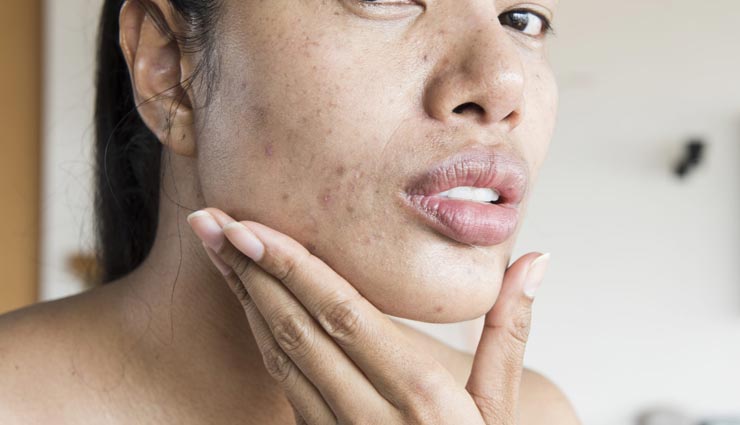 glycerin,beauty benefits of glycerin,glycerin for skin,skin care tips,beauty tips