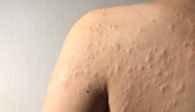 beauty benefits of glycerin,glycerin during winters,beauty tips,skin care tips