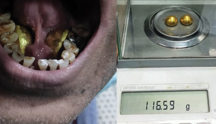 जयपुर : कस्टम ड्यूटी बचाने के चक्कर में शख्स जीभ के नीचे छुपाकर दुबई से लाया था सोने की दो गोलियां 