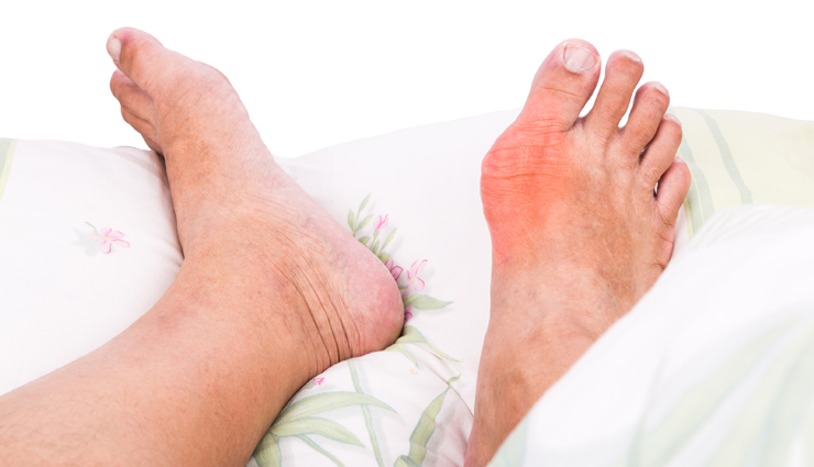 golden berries,health benefits of golden berries,Health tips,fitness tips