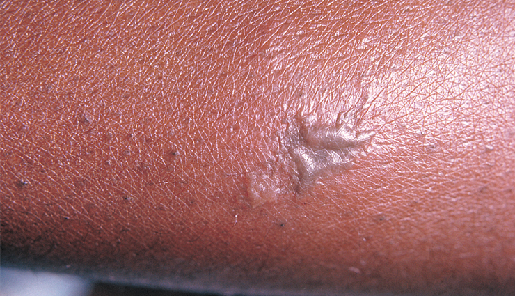 annatto,annatto health benefits,annatto benefits,Health,Health tips