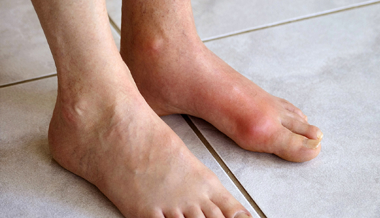 coffee,coffee health benefits,coffee for good health,health coffee,healthy food coffee,Health,Health tips