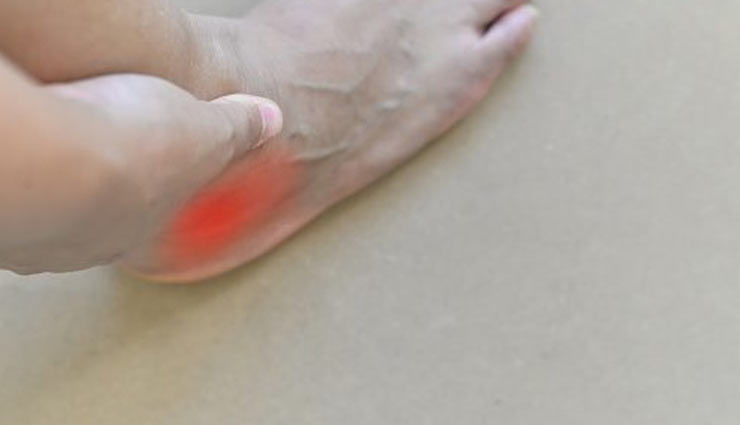 gout pain,home remedies for gout pain,pain cure tips,home remedies,Health tips,fitness tips