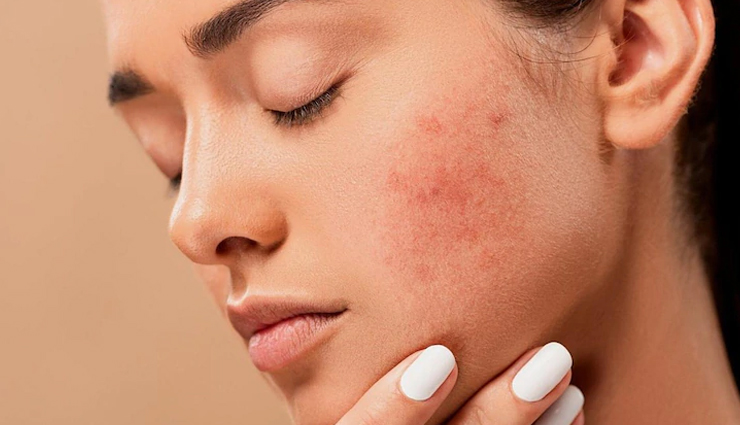 diy gram flour face mask,skin care tips,beauty tips,gram flour for skin