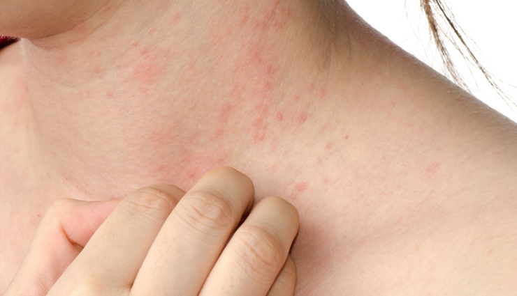 grapes,harmful effects of eating too many grapes,side effects of eating grapes,Health tips,fitness tips