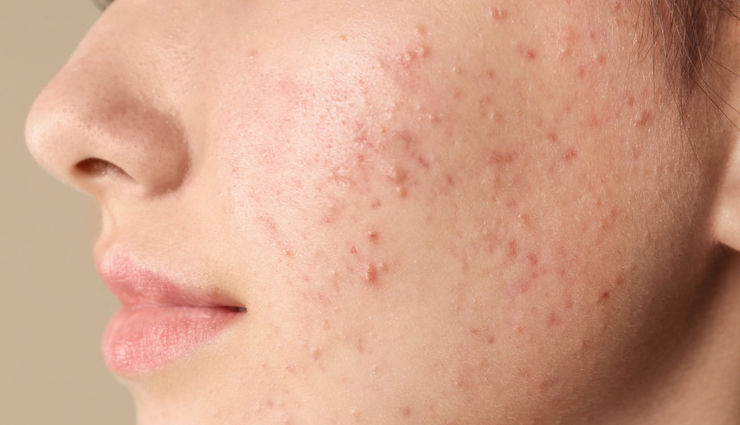 grapeseed oil,grapeseed oil for skin,grapeseed oil for hair,beauty tips,skin care tips,beauty tips