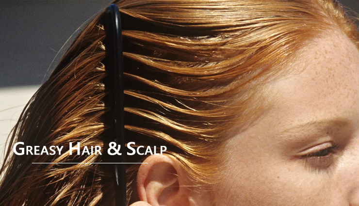 girl faces,hair problem,hair problem every girl face,hair loss,hair treatment,hair care tips,hair care,hair loss,beauty,beauty tips