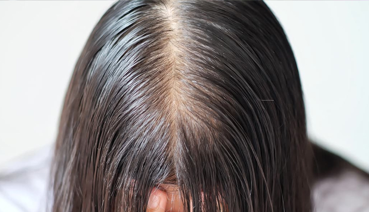 8 DIY Ways To Get Rid of Greasy Hair Naturally
