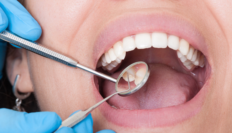 green tea,health benefits of green tea,Health tips,fitness tips