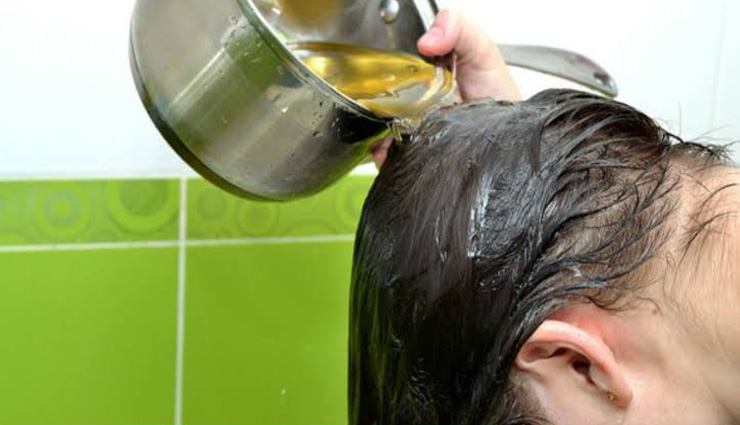 dandruff treatment,home remedies dandruff,scalp,dandruff treatment,dandruff funguss,beauty,beauty tips