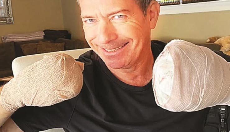 64 दिन तक चली शख्स की कोरोना से जंग, जान बची लेकिन गंवा बैठे हाथों की उंगलियां, दर्दनाक आपबीती