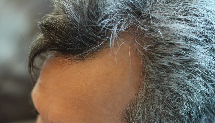 grey hair home remedies,natural remedies for grey hair,prevent grey hair,treat premature greying,herbal treatments for grey hair,grey hair reversal,diy grey hair treatments,grey hair care tips,grey hair remedies,remedies for aging hair