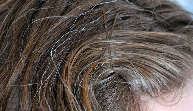 10 Home Remedies To Prevent Your Hair From Greying 