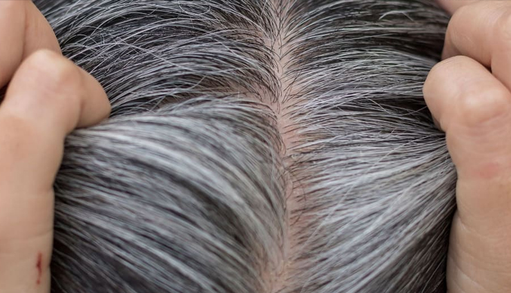 6 DIY Hair Oils To Treat Gray Hair