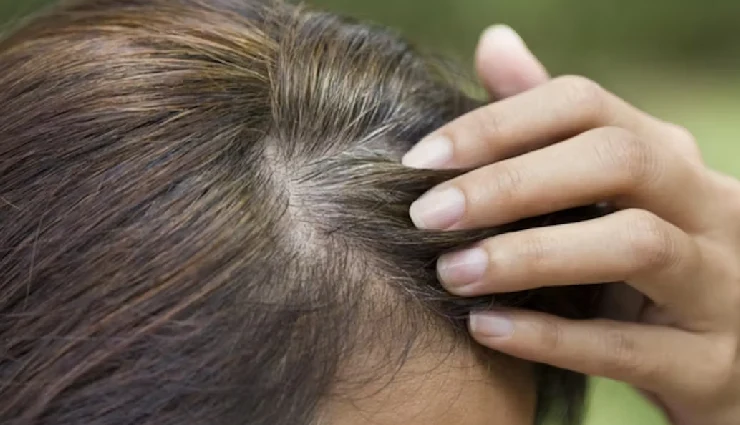 10 Causes That Make Your Hair Turn Grey