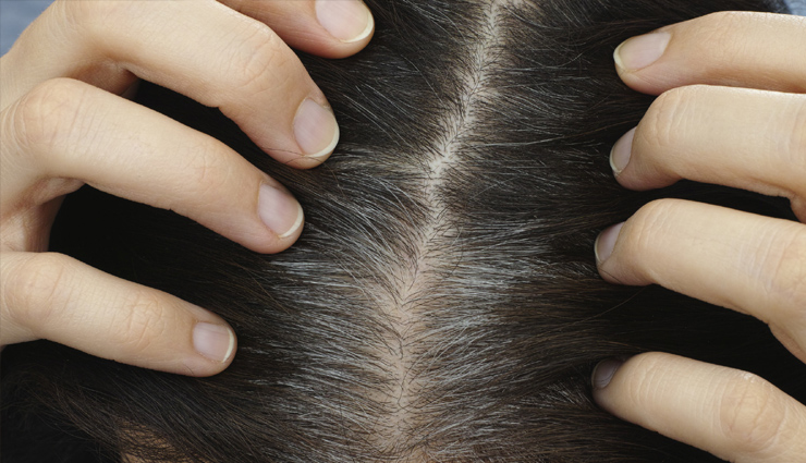 2 DIY Hair Oil To Treat Grey Hair at Home