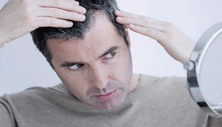 5 Home Remedies To Stop Hair From Greying