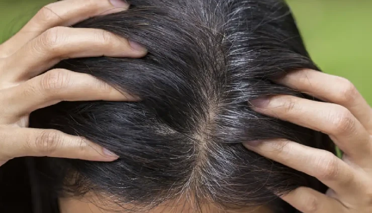 rosemary seeds for hair,benefits of rosemary seeds,rosemary seeds hair growth,natural remedies for hair fall,diy rosemary hair treatment,rosemary seeds dandruff cure,how to use rosemary seeds for hair,rosemary seeds scalp health,herbal treatment for hair,rosemary seeds oil infusion