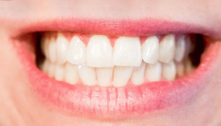 आपकी ये आदतें बनती हैं दांतों की परेशानियों का कारण, इनमें सुधार करना बहुत जरूरी tooth-damaging behaviors,oral health-harming practices,teeth-harming routines,habits that harm dental hygiene,harmful oral care practices,dental health detrimental habits,teeth-damaging lifestyle choices,oral habits impacting teeth negatively,detrimental dental behaviors,harmful routines for teeth