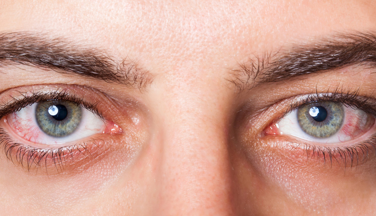 guava,health benefits of guava,Health tips,fitness tips