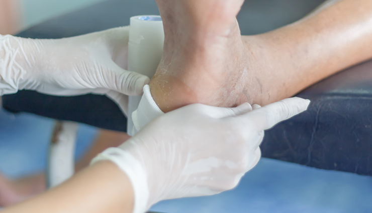 guava,health benefits of guava,Health tips,fitness tips