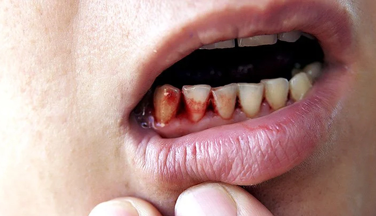 guava,health benefits of guava,Health tips,fitness tips