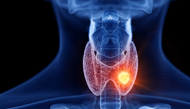 guava,health benefits of guava,Health tips,fitness tips