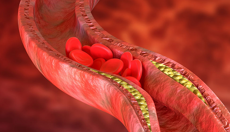 consuming guava rich in nutrients gives these benefits to health,lets know,Health,healthy living