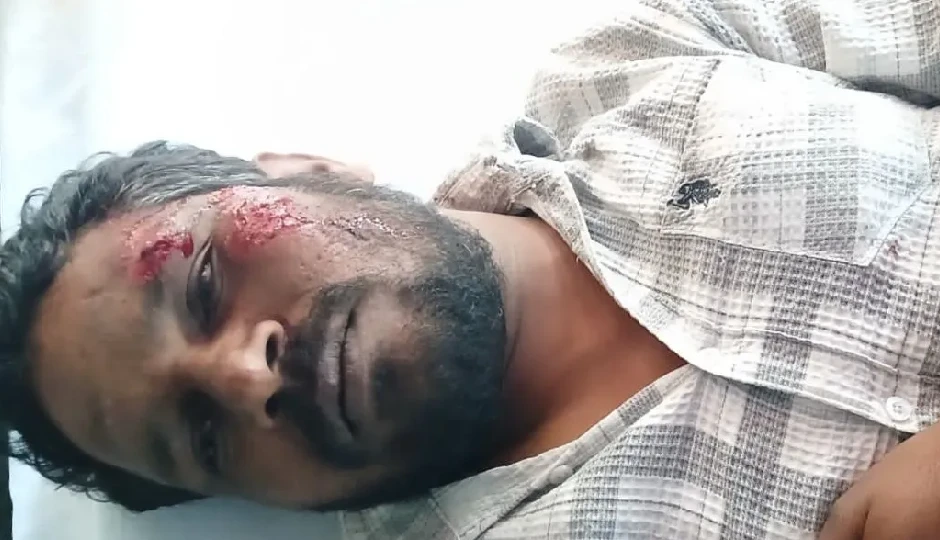 गुड़ के पैसे मांगना युवक को पड़ा भारी...कार सवार ने खिड़की पर लटकाकर आधा किलोमीटर तक घसीटा