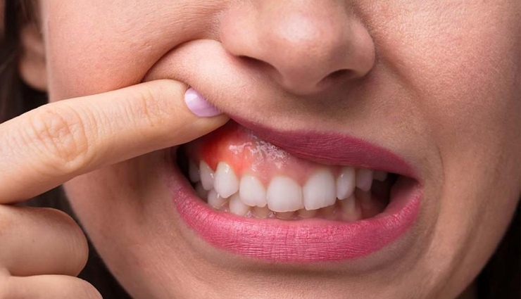 पारंपरिक रूप से भारतीय तकनीक है ऑयल पुलिंग, इस्तेमाल से मिलते हैं ये गजब के फायदे oil pooling,what is oil pooling,benefits of oil pooling,oil pooling good for health,healthy habits,Health,Health tips,healthy living