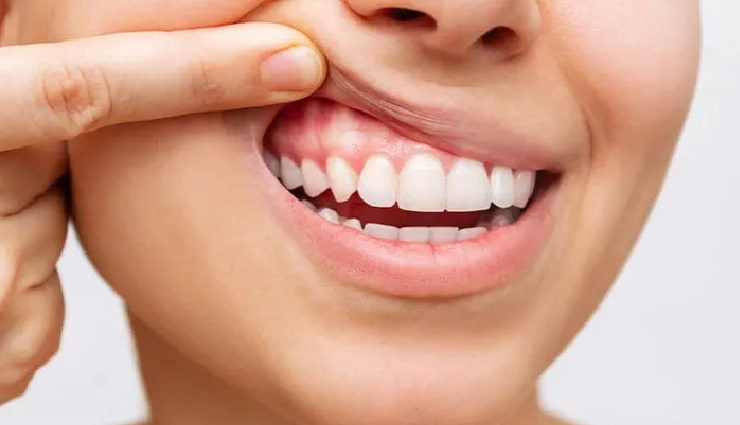 proper tooth brushing duration,dental health tips,avoid overbrushing,two-minute brushing rule,gum recession prevention,enamel erosion risks,soft tissue damage from brushing,tooth sensitivity prevention,how often to brush teeth,dental care advice,oral hygiene tips,brushing technique importance,tooth sensitivity management,dental health recommendations,importance of balanced brushing,preventing dental issues,enamel protection strategies,brushing frequency guidelines,tooth brushing duration limits,oral health preservation