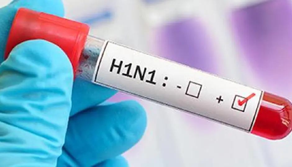 दिल्ली में H1N1 के 2,308 मामले, DMA ने जारी की एडवाइजरी; भीड़भाड़ से बचने की सलाह