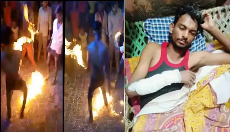 मुंह में पेट्रोल भरकर करतब दिखाने के दौरान हुआ हादसा, 5 बच्चों समेत 8 लोग झुलसे 