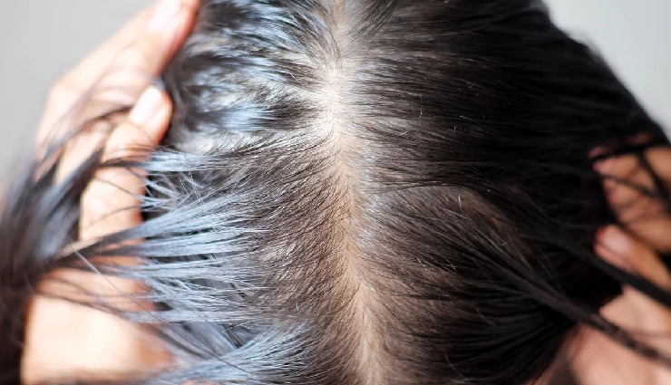 apples benefits for skin,apples for hair growth,apples for glowing skin,apples for dandruff control,apple mask for skin,apple hair pack,apples for anti-aging,apple beauty remedies,apples for scalp health,apples for shiny hair,apples skincare benefits,apples natural exfoliant,apple fruit for healthy skin and hair