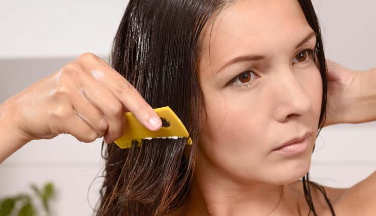 बालों के लिए परेशानी बनती हैं जुओं की समस्या, आजमाएं ये घरेलू उपाय 