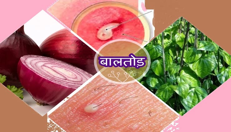 ये 5 नुस्खें दिलाएंगे बालतोड़ में आपको राहत, जानें और आजमाए