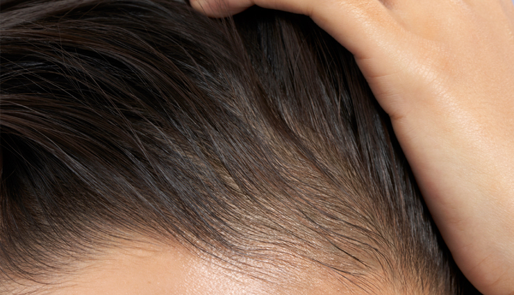 Natural Remedies To Treat Hair Breakage Effectively