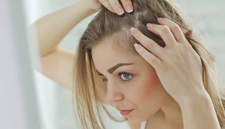 cinnamon oil,cinnamon oil benefits,cinnamon oil hair benefits,cinnamon oil for healthy hair,hair,hair care tips,healthy hair tips,beauty,beauty tips