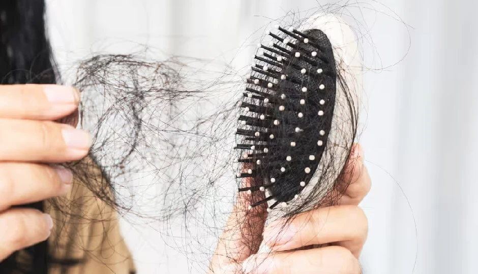 बाल तेजी से झड़ रहे हैं...इन 4 चीज़ों को तुरंत डाइट से हटाएं