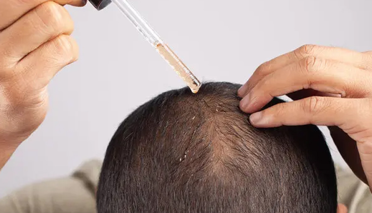 preventing male baldness,lifestyle changes for hair loss,male pattern baldness prevention,stopping hair loss in men,lifestyle modifications for balding,ways to prevent male hair loss,hair loss prevention tips for men,preventing baldness in males naturally,lifestyle habits to stop male balding,male hair loss prevention strategies,dietary changes for hair loss prevention,male baldness prevention methods,exercise and male hair loss,stress reduction for hair loss prevention,male hair care lifestyle changes,scalp care to prevent balding,hormonal balance and hair loss prevention,lifestyle choices to prevent male pattern baldness,male grooming habits for hair health,vitamins for male hair loss prevention,natural remedies for preventing male baldness,healthy habits for strong male hair