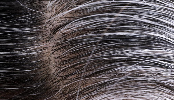 potato,potato peel,health benefits of potato peel,potato peel for healthy living,Health tips,healthy food potato peel