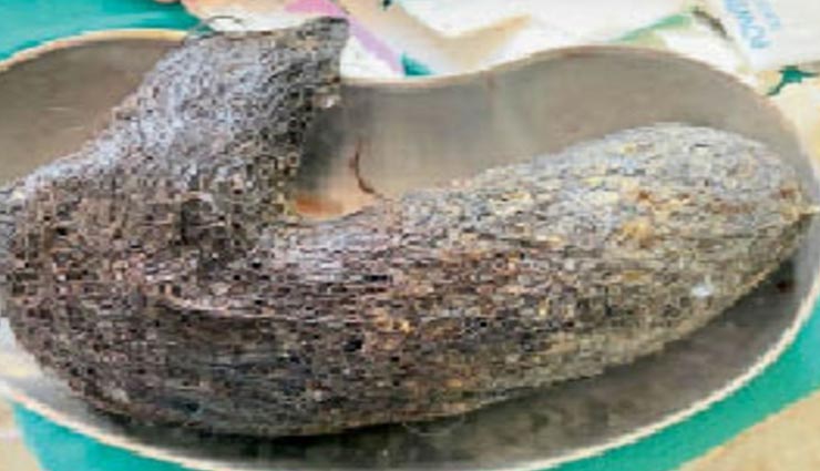 बच्ची के पेट से निकला 1 फुट लंबा व 10 सेंटीमीटर मोटा बालों का गुच्छा, देखकर सभी हैरान