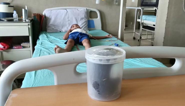 दर्द होने के बाद 5 साल की बच्ची का हुआ ऑपरेशन, पेट में निकला कुछ ऐसा कि डॉक्टर्स भी रह गए हैरान