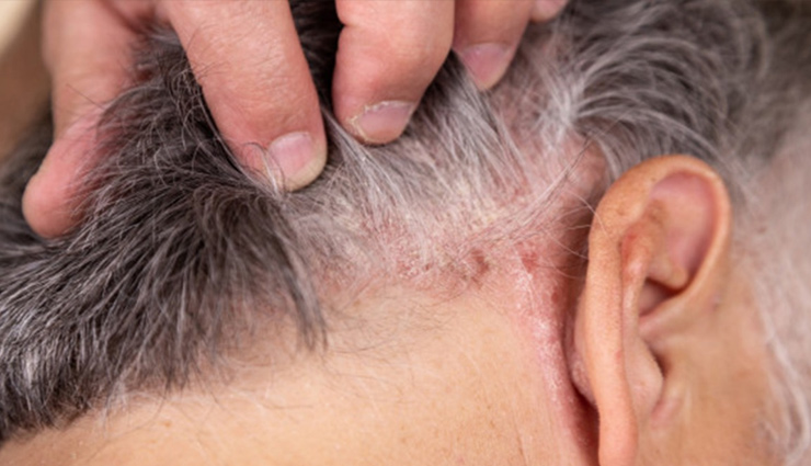 apple cider vinegar health benefits,benefits of consuming apple cider vinegar,health advantages of apple cider vinegar,apple cider vinegar benefits for the body,why apple cider vinegar is beneficial for health,apple cider vinegar advantages,uses and benefits of apple cider vinegar,health perks of apple cider vinegar consumption,apple cider vinegar for wellness,apple cider vinegar and its health effects,apple cider vinegar benefits for the body,apple cider vinegar advantages for health,why apple cider vinegar is good for you,apple cider vinegar benefits and uses,apple cider vinegar properties and benefits